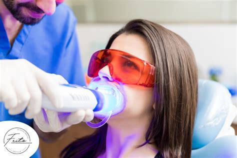 Todo lo que Debes Saber sobre el Blanqueamiento Dental Clínica Dental