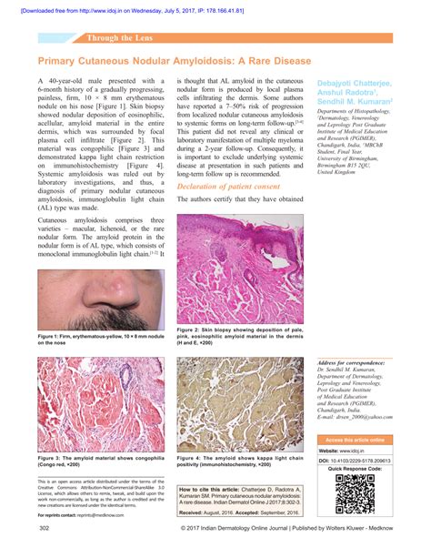 Pdf Primary Cutaneous Nodular Amyloidosis A Rare Disease