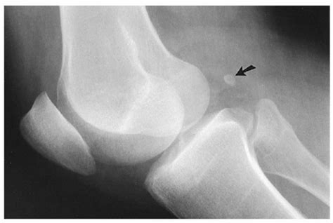 MSK Week 3 Knee Examination Flashcards Quizlet