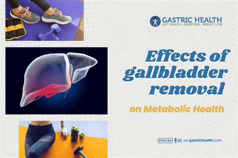 Effects Of Gallbladder Removal On Metabolic Health Gastric Health