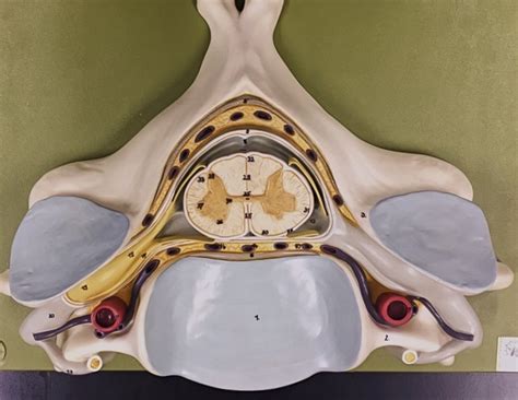 Cross Section of Spinal Cord- Lab Model Diagram | Quizlet