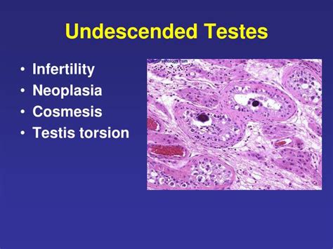 Ppt Urogenital Tract Male Development Powerpoint Presentation Id