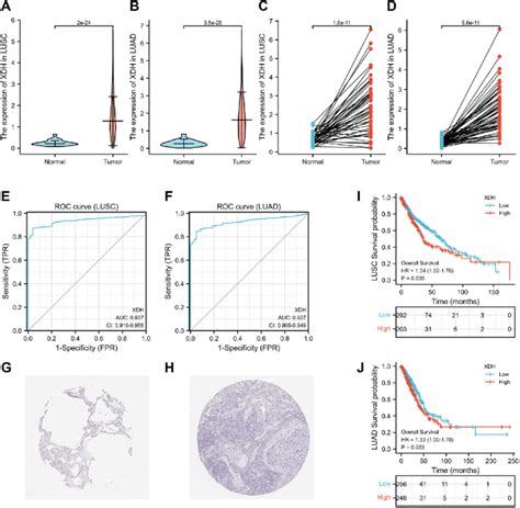 Xdh Expression Level Was Positively Correlated With Nsclc A And B