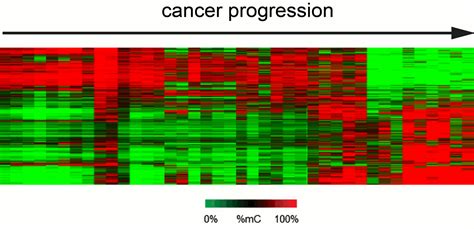 Ijms Free Full Text Defining Driver Dna Methylation Changes In