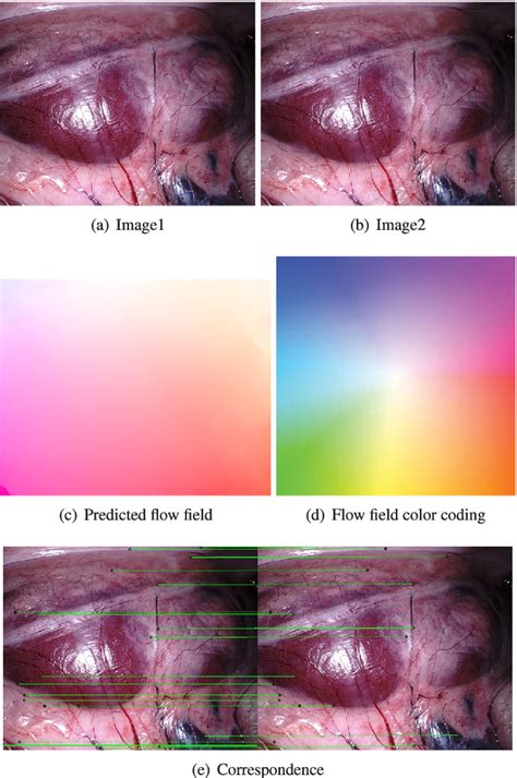 Figure 2 From Robust Endoscopic Image Mosaicking Via Fusion Of