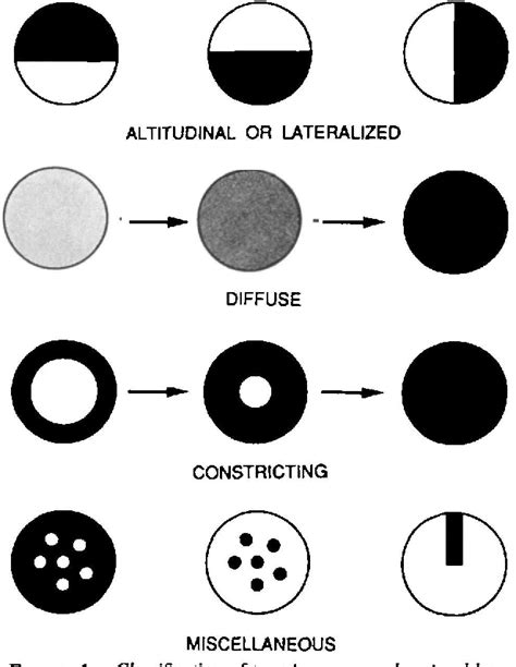 Figure 1 From Transient Monocular Visual Loss Patterns And Associated