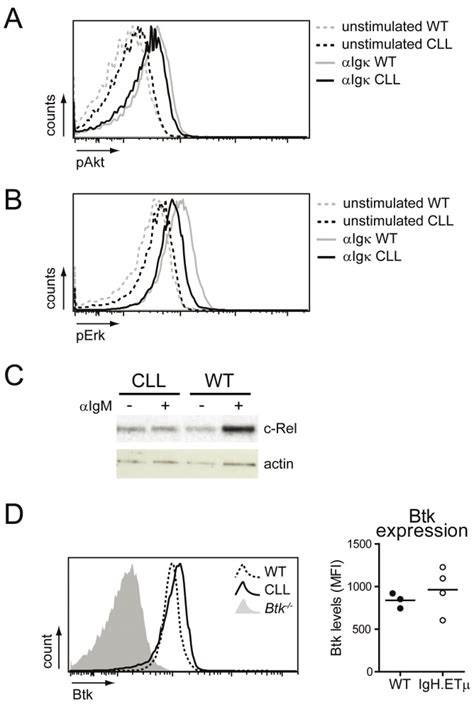 Brutons Tyrosine Kinase Mediated Signaling Enhances Leukemogenesis In