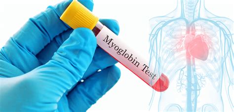 Miyoglobin Testi Tetra Tıp Laboratuvarı