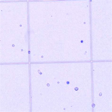 Preparation Of Single Cell Suspensions From Human Intestinal Biopsies