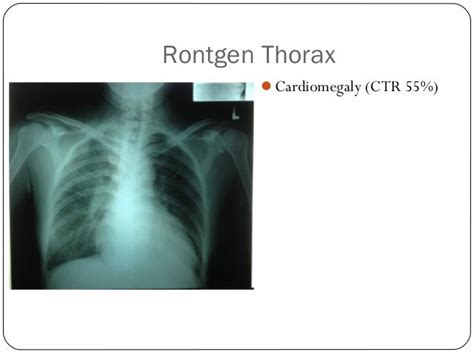 Ckd And Hhd Duty Report Department Of Internal Medicine Rsapad Gatot