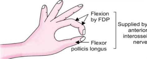 Upper Limb Nerve Lesions Part 3 The Median Nerve Medical Exam