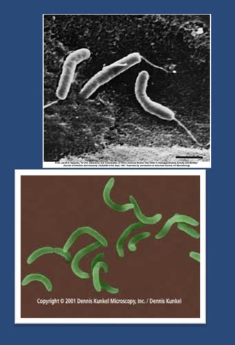 Microbiology Vibrios Campylobacter And Helicobacter Flashcards