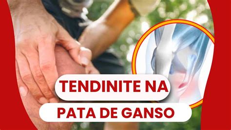 Tendinite Da Pata De Ganso Entenda A Patologia E Os Sintomas YouTube