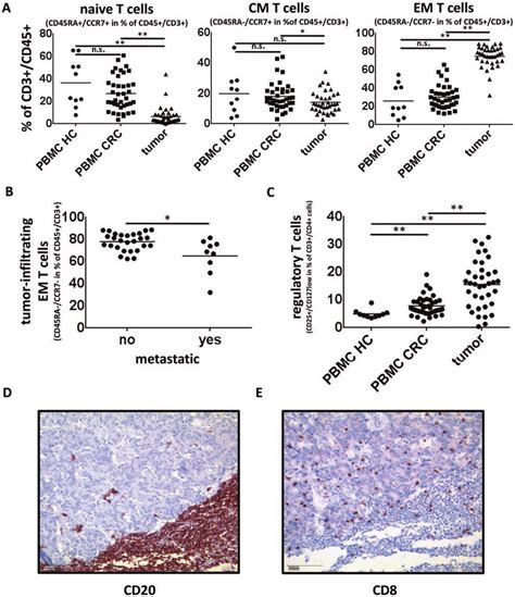 Tumor Infiltrating T Cells In Colorectal Cancer A Tumor Infiltrating