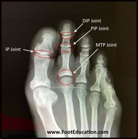 Bones And Joints Of The Foot And Ankle Overview Footeducation