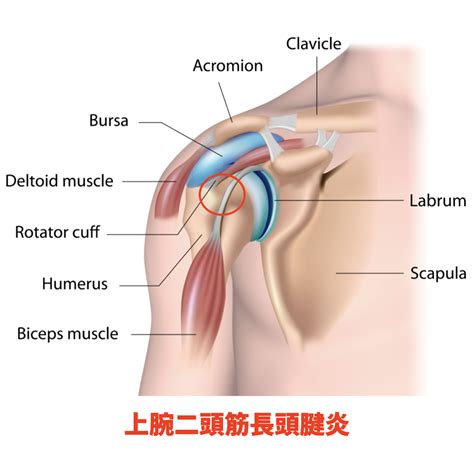 四十肩・五十肩とは 腕が上がらない原因、注意すべき症状・治療法