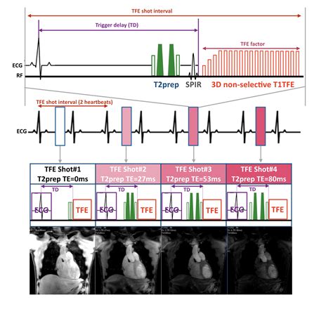 Figure 1 Scheme Of The Sequence For 3d Isotropic Myocardial T2 Mapping