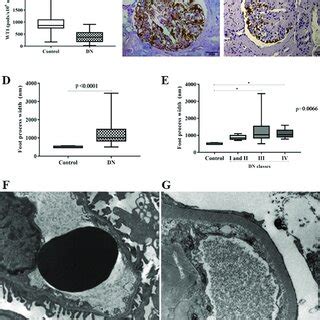 Podocyte Density And Foot Process Effacement In Renal Biopsies Of