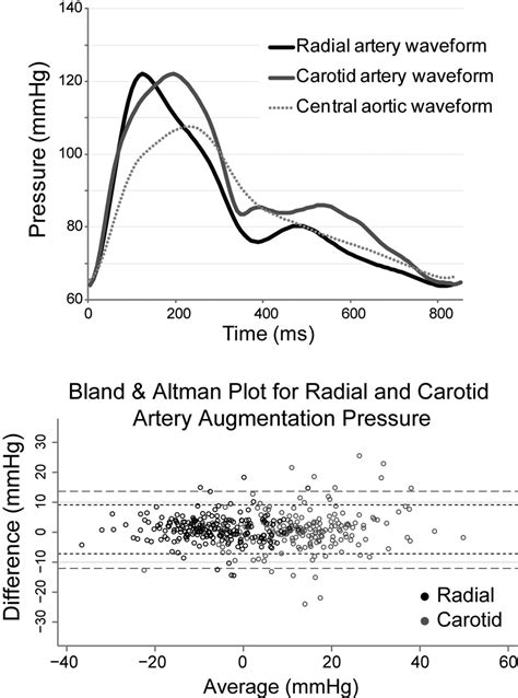 134 PERIPHERAL ARTERIAL WAVEFORMS FOR THE PREDICTION OF CARDIOVASCULAR