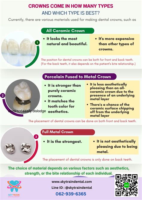 What type of dental crown? - Skytrain Dental