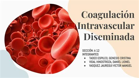 Coagulación intravascular diseminada victor vasquez uDocz