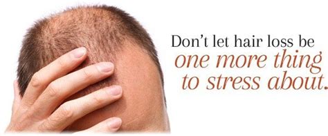 How To Prevent Hair Loss Due To Stress