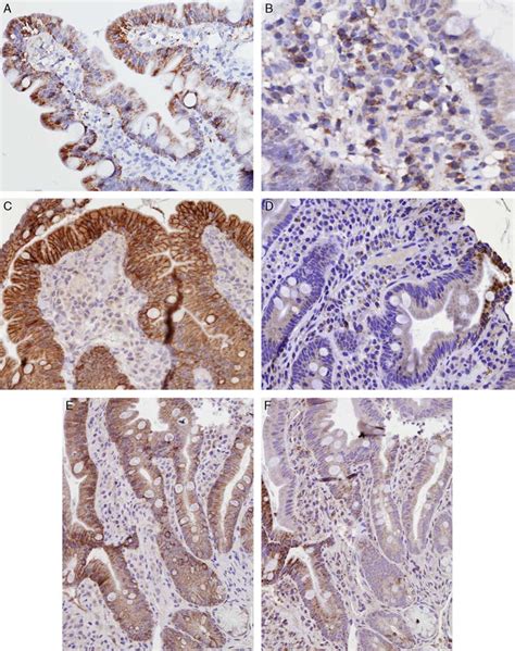 Immunohistochemical Findings In Duodenal Mucosa Sections From NCGS