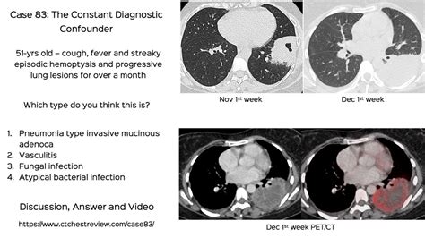 Case The Constant Diagnostic Confounder