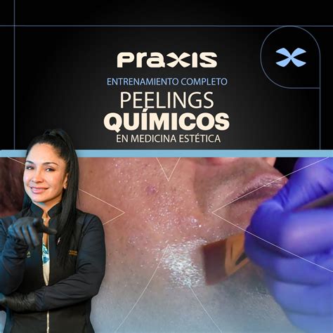 Entrenamiento de Peeling en Medicina Estética Praxis Studio Hot