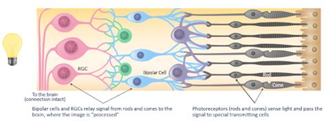 Molecular Photoswitches A New Hope For Ird Patients