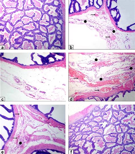 Photomicrograph Of Rat Seminal Vesicles Stained With He × 200 Scale