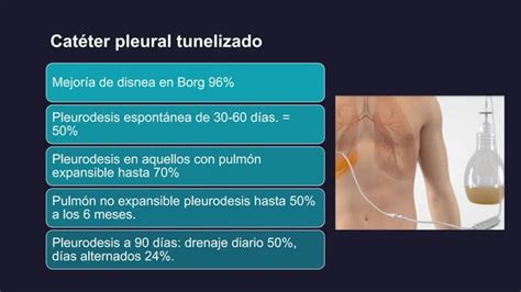 Derrame Pleural Maligno Pptx Descarga Gratuita