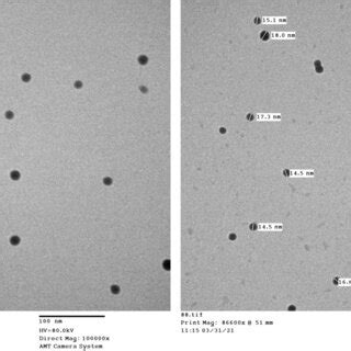 Representative Transmission Electron Microscopy Analysis Of Prepared