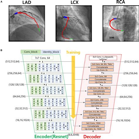 Frontiers A Simple Method For Automatic 3d Reconstruction Of Coronary