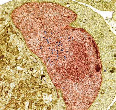 Epstein Barr Virus Infection Tem Photograph By Steve Gschmeissner