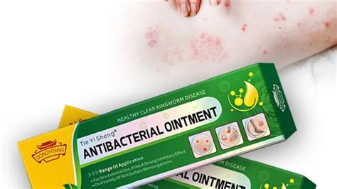 Free Sample Dermatitis Eczema Fungal Infection Ointment For The