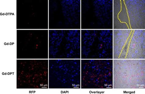 Full Article Magnetic Resonance Guided Regional Gene Delivery Strategy