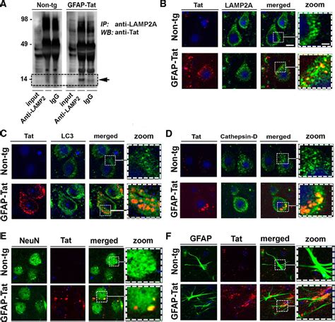 Hiv Tat Alters Neuronal Autophagy By Modulating Autophagosome Fusion