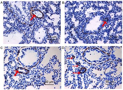 Immunohistochemical staining for α SMA in lung tissue sections isolated