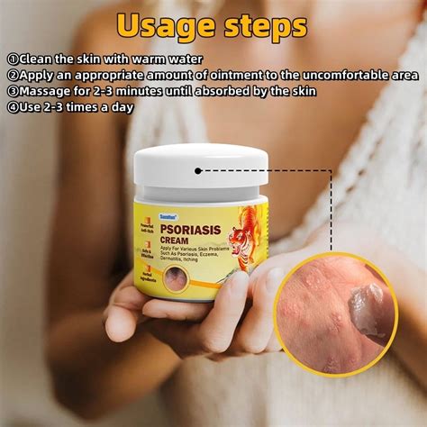 Psoriasis Cream Ubat Gatal Kulit Ubat Kurap Quickly Sterilize And