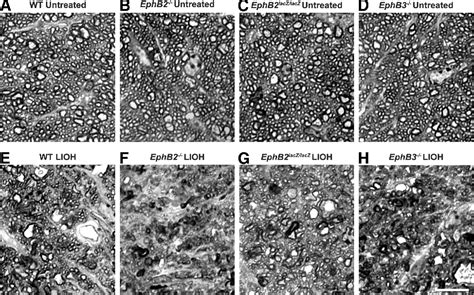 Figure 2 From Involvement Of EphB Ephrin B Signaling In Axonal Survival