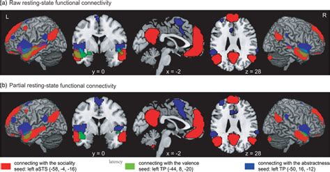 Resting‐state Functional Connectivity Maps Of The Atl Subregions For Download Scientific