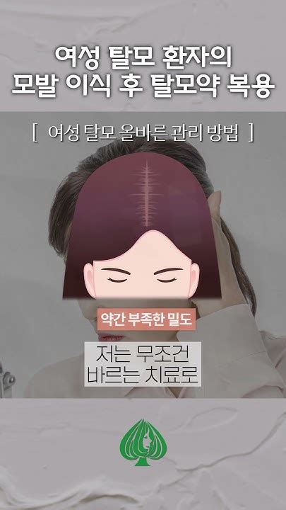 여성 탈모 환자 모발 이식 후 탈모약 복용은 어떻게 탈모 모발이식 여성탈모 여성환자 탈모약 강남모발이식