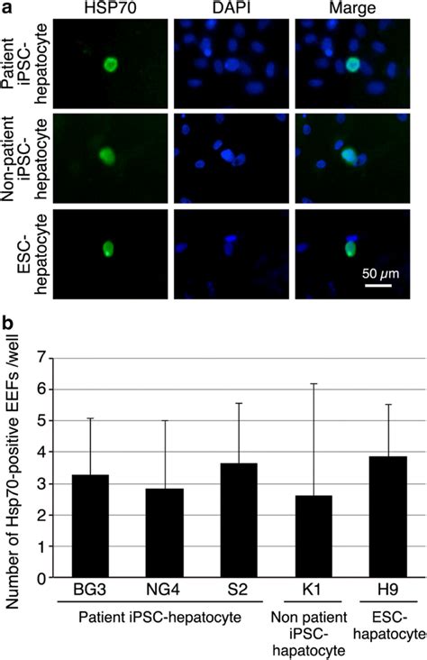 Plasmodium Vivax Liver Stage Assay Platforms Using Indian Clinical