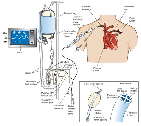 Cardiac Hemodynamics