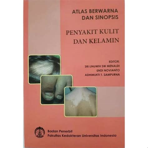 Jual Atlas Berwarna Dan Sinopsis Penyakit Kulit Dan Kelamin Original