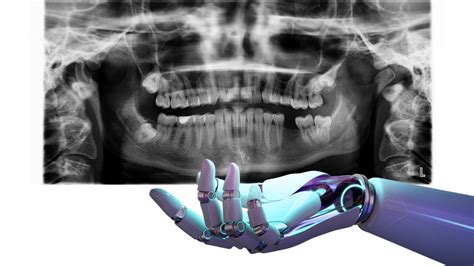 Cómo te puede ayudar IA aplicada a una clínica dental Juan Armada