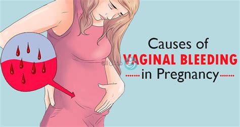 Vaginal Bleeding Dr Wael Elbanna