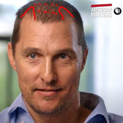 Matthew McConaughey Hair Loss Secrets Revealed!