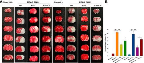 Effects Of Compound C CC On MCAO Induced Cerebral Infarction A